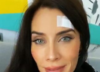 Pilar Rubio se clava un tornillo en la frente