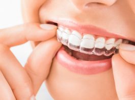 Los odontólogos alertan sobre el uso de alineadores dentales