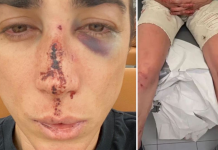 Un joven de 19 años sufre una agresión homófoba en Alginet