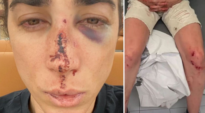 Una brutal agresión homófoba deja a dos jóvenes heridos en Alginet Un joven de 19 años sufre una agresión homófoba en Alginet