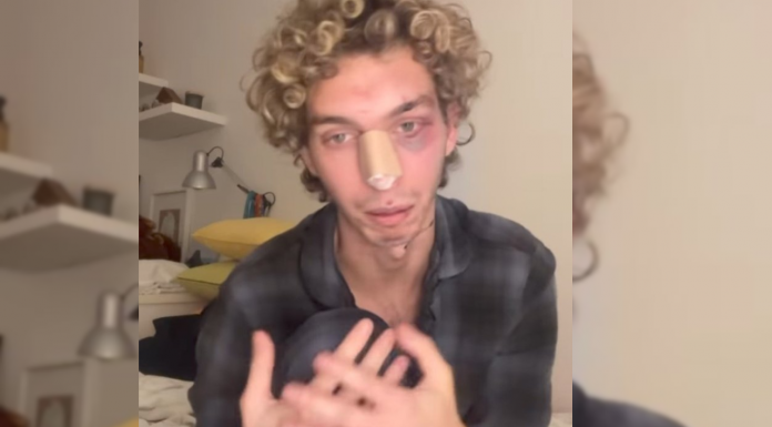 Denuncian una brutal agresión homófoba en Valencia: «Pensaba que me moría» Denuncian una brutal agresión homófoba en Valencia: "Pensaba que me moría"