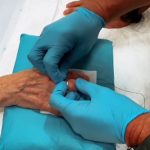 Consiguen sacar un anillo atascado a una mujer entre dos bomberos