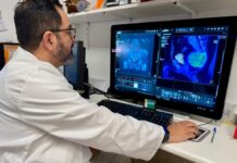 El Hospital Doctor Peset innova en la localización de tumores complejos de columna